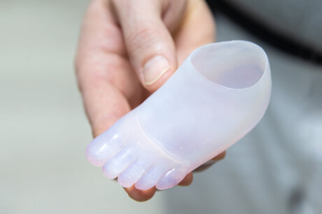 Probe-Fußprothese für Baby | © Pohlig GmbH