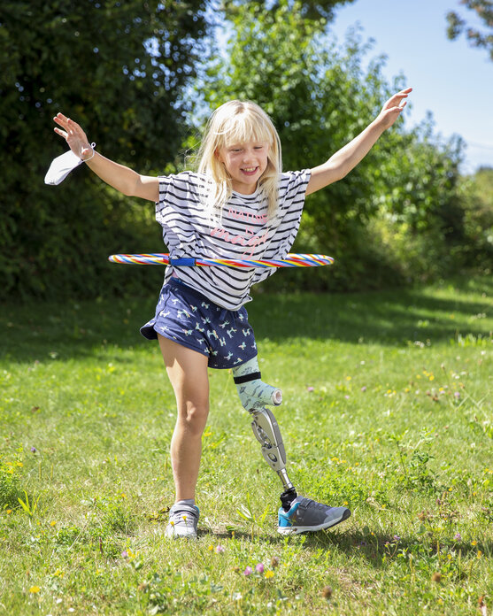 Mädchen springt durch  Huler-Hoop-Reifen mit ihrer Orthoprothese  | © Pohlig GmbH