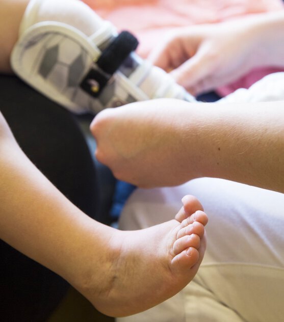 Anprobe einer Fußorthese bei einem Kleinkind aufgrund einer Fußfehlstellung. | © Pohlig GmbH