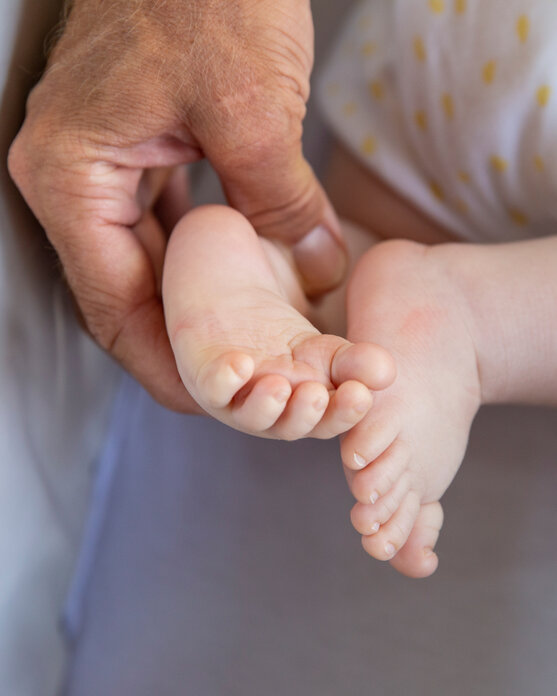 Baby mit Fußfehlstellung. | © Pohlig GmbH