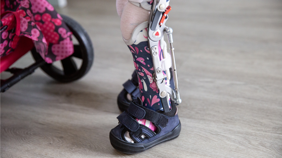 Kleine Patientin Sophie geht am Puppenwagen. | © Pohlig GmbH