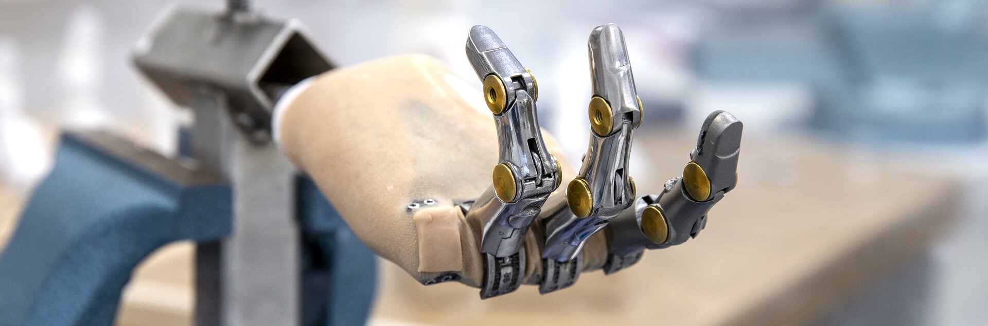 Anfertigung einer Teilhandprothese | © Pohlig GmbH