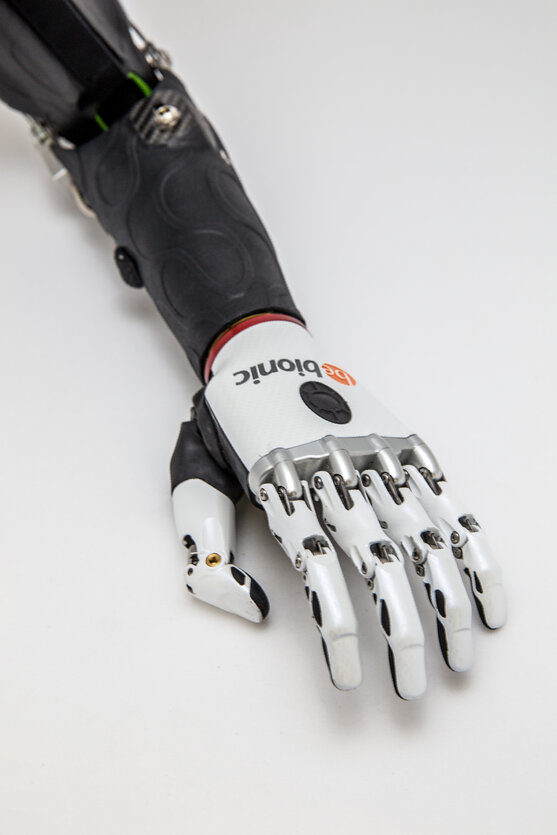 Myoelektrische Armprothese | Orthopädie-Technik | Pohlig GmbH