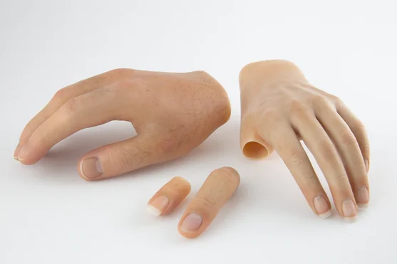Silicone finger prosthesis