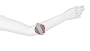 Ellenbogenspange -   Epi Flex